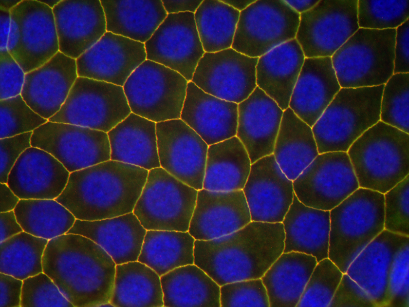mdcki10dpc-cla1occ.jpg