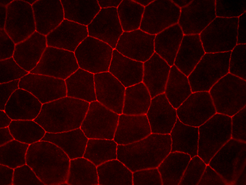 mdcki10dpc-occ.jpg