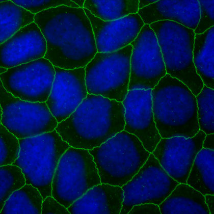 mdckii10dpc-cla2.jpg