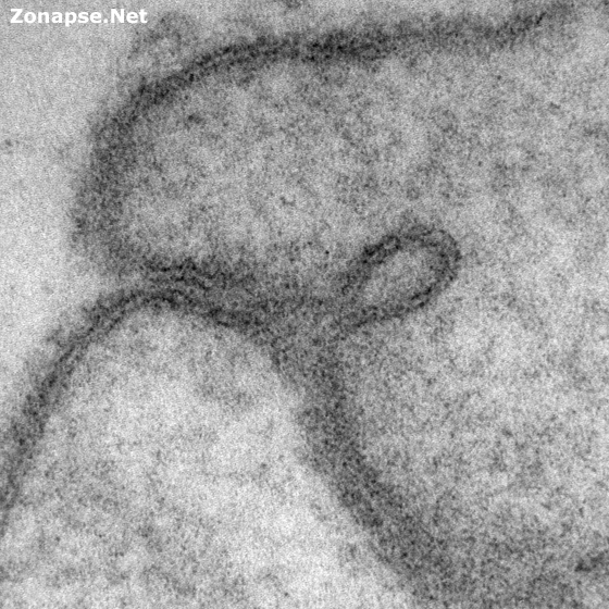 vesicle.jpg